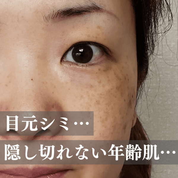 目元シミ...